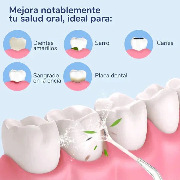 ORALWAVE™ - Irrigador bucal portátil - Limpieza profunda + OBSEQUIO