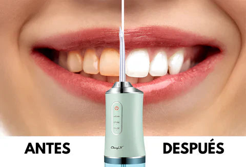 ORALWAVE™ - Irrigador bucal portátil - Limpieza profunda + OBSEQUIO