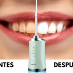 ORALWAVE™ - Irrigador bucal portátil - Limpieza profunda + OBSEQUIO