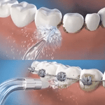 ORALWAVE™ - Irrigador bucal portátil - Limpieza profunda + OBSEQUIO