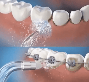 ORALWAVE™ - Irrigador bucal portátil - Limpieza profunda + OBSEQUIO