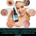 Dile Adios a las Verrugas con VerryClean + Envio Gratis